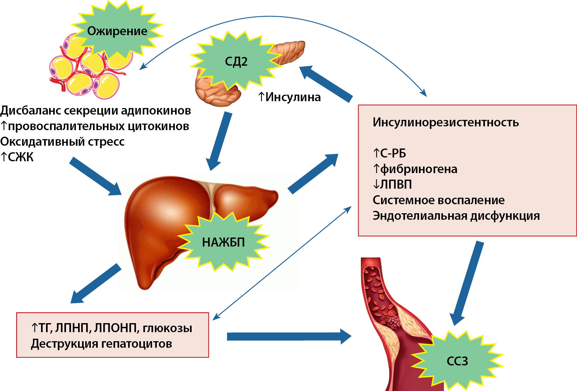 Инсулинорезистентность как лечить в домашних условиях. Механизм развития инсулинорезистентности при ожирении. Инсулинорезистентность патогенез инсулинорезистентности. Метаболический синдром и инсулинорезистентность. Сахарный диабет инсулин резистентность.
