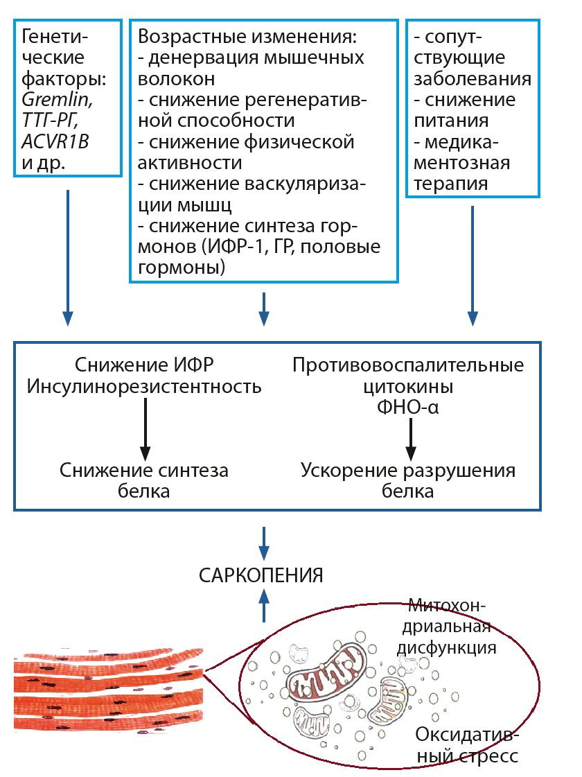 Саркопения это простыми словами. Саркопения патогенез. Механизм развития саркопении. Возрастная саркопения. Саркопения ожирения.